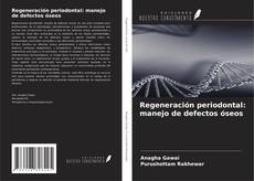 Copertina di Regeneración periodontal: manejo de defectos óseos