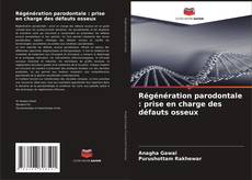 Régénération parodontale : prise en charge des défauts osseux的封面