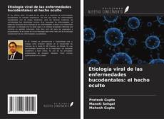 Couverture de Etiología viral de las enfermedades bucodentales: el hecho oculto