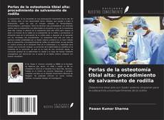Copertina di Perlas de la osteotomía tibial alta: procedimiento de salvamento de rodilla