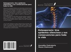 Couverture de Osteoporosis: Una epidemia silenciosa y sus consecuencias para toda la vida