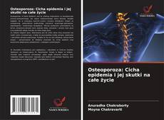 Couverture de Osteoporoza: Cicha epidemia i jej skutki na całe życie