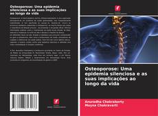 Buchcover von Osteoporose: Uma epidemia silenciosa e as suas implicações ao longo da vida