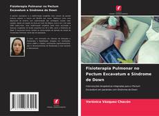 Couverture de Fisioterapia Pulmonar no Pectum Excavatum e Síndrome de Down