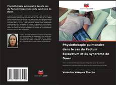 Обложка Physiothérapie pulmonaire dans le cas du Pectum Excavatum et du syndrome de Down