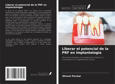 Liberar el potencial de la PRF en implantología的封面