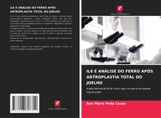 Buchcover von IL6 E ANÁLISE DO FERRO APÓS ARTROPLASTIA TOTAL DO JOELHO
