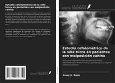 Buchcover von Estudio cefalométrico de la silla turca en pacientes con malposición canina