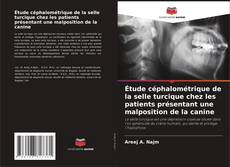 Étude céphalométrique de la selle turcique chez les patients présentant une malposition de la canine kitap kapağı