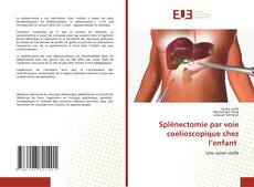 Bookcover of Splénectomie par voie coelioscopique chez l’enfant