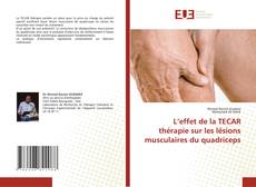Couverture de L’effet de la TECAR thérapie sur les lésions musculaires du quadriceps