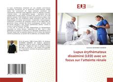 Lupus érythémateux disséminé (LED) avec un focus sur l’atteinte rénale的封面
