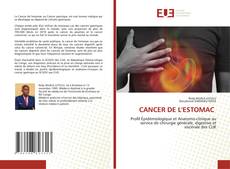 CANCER DE L'ESTOMAC的封面