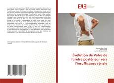 Évolution de Valve de l’urètre postérieur vers l'insuffisance rénale的封面