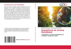 Borítókép a  Dispositivos de Avance Mandibular - hoz