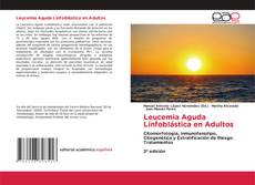Capa do livro de Leucemia Aguda Linfoblástica en Adultos 