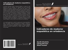 Buchcover von Indicadores de madurez esquelética en ortodoncia