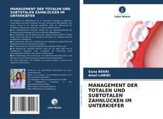 Borítókép a  MANAGEMENT DER TOTALEN UND SUBTOTALEN ZAHNLÜCKEN IM UNTERKIEFER - hoz