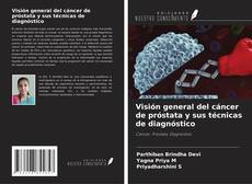 Buchcover von Visión general del cáncer de próstata y sus técnicas de diagnóstico