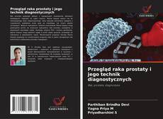 Borítókép a  Przegląd raka prostaty i jego technik diagnostycznych - hoz