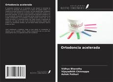 Buchcover von Ortodoncia acelerada