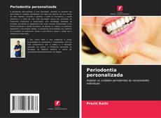 Buchcover von Periodontia personalizada