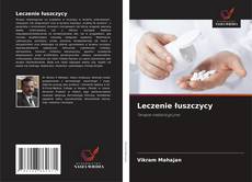 Bookcover of Leczenie łuszczycy