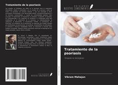 Buchcover von Tratamiento de la psoriasis