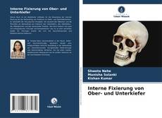 Bookcover of Interne Fixierung von Ober- und Unterkiefer