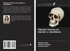 Buchcover von Fijación interna en maxilar y mandíbula