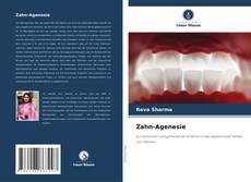 Borítókép a  Zahn-Agenesie - hoz
