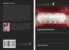 Couverture de Agenesia dentaria