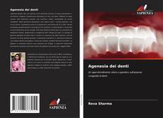 Copertina di Agenesia dei denti