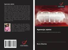 Buchcover von Agenezja zębów