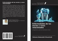 Buchcover von Enfermedades de las encías y casos relacionados