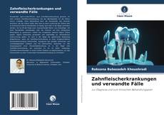 Borítókép a  Zahnfleischerkrankungen und verwandte Fälle - hoz