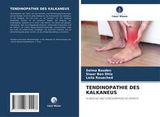 Borítókép a  TENDINOPATHIE DES KALKANEUS - hoz