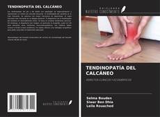 Buchcover von TENDINOPATÍA DEL CALCÁNEO