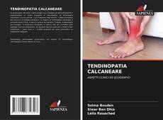 Copertina di TENDINOPATIA CALCANEARE