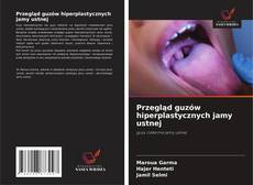 Przegląd guzów hiperplastycznych jamy ustnej的封面