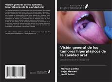 Buchcover von Visión general de los tumores hiperplásicos de la cavidad oral