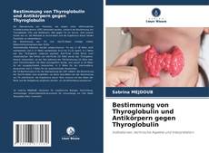 Borítókép a  Bestimmung von Thyroglobulin und Antikörpern gegen Thyroglobulin - hoz