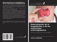 Buchcover von Determinación de la tiroglobulina y de los anticuerpos antitiroglobulina
