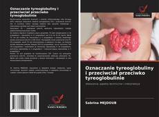 Oznaczanie tyreoglobuliny i przeciwciał przeciwko tyreoglobulinie的封面