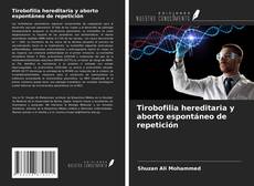 Borítókép a  Tirobofilia hereditaria y aborto espontáneo de repetición - hoz