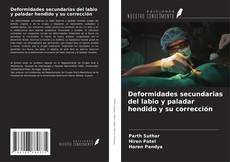 Bookcover of Deformidades secundarias del labio y paladar hendido y su corrección