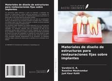 Buchcover von Materiales de diseño de estructuras para restauraciones fijas sobre implantes