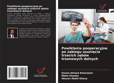 Bookcover of Powikłania pooperacyjne po zabiegu usunięcia trzecich zębów trzonowych dolnych