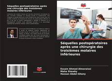 Bookcover of Séquelles postopératoires après une chirurgie des troisièmes molaires inférieures