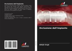 Couverture de Occlusione dell'impianto